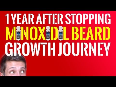 Did The Minoxidil Beard Stay? | 1 Year Off Minoxidil for Beard Growth