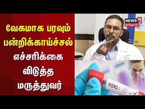Swine Flu Symptoms | வேகமாக பரவும் பன்றிக்காய்ச்சல் - எச்சரிக்கை விடுத்த மருத்துவர் | N18V