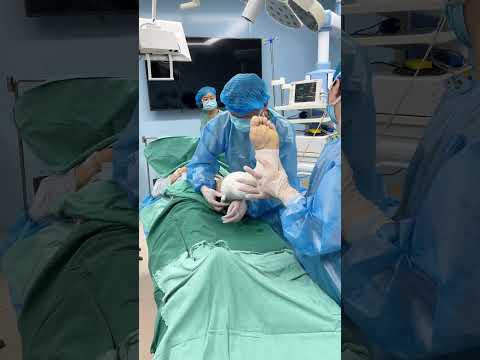 揭秘手术,病人从手术到结束 #doctor #hospital#hospital