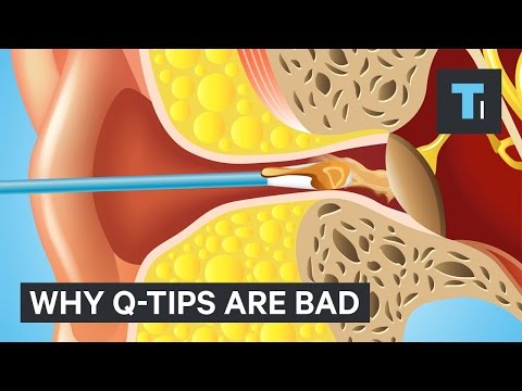 Why Q-Tips are bad - UCVLZmDKeT-mV4H3ToYXIFYg