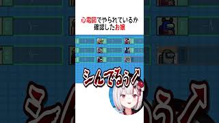 心電図でやられているか確認したお嬢【ホロライブ切り抜き】#shorts #百鬼あやめ