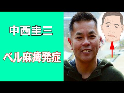 中西圭三が顏面神經麻痺發症。