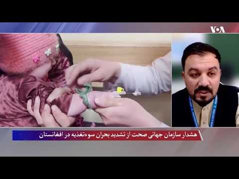 هشدار سازمان جهانی صحت؛ بحران سوتغذیه در افغانستان عمیق‌تر می‌شود