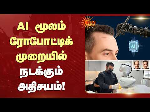 AI மூலம் ரோபோட்டிக் முறையில் நடக்கும் அதிசயம்! | AI Robotic Hair Transplant | Sun News
