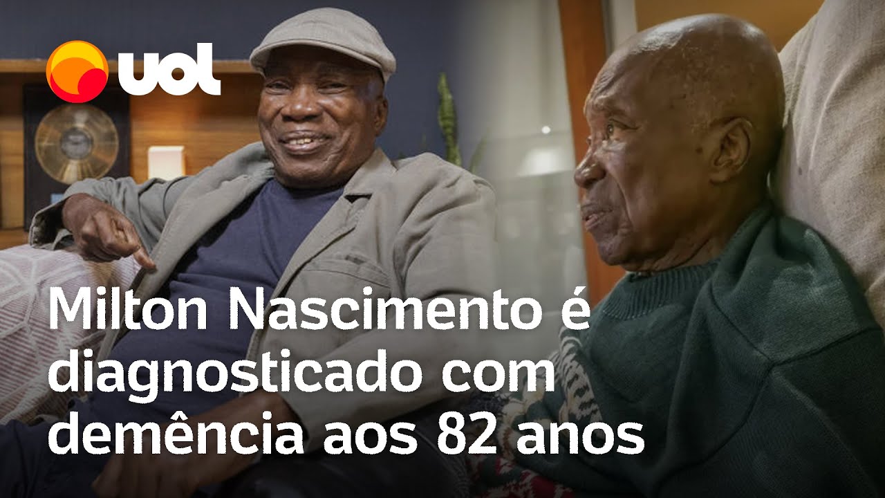Cantor Milton Nascimento recebe diagnóstico de demência por corpos de Lewy