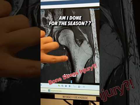 Am I done for the season??