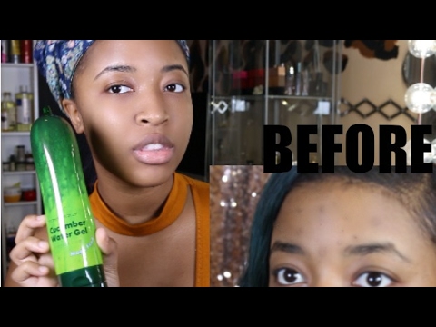 How To Get Rid Of Dark Spots Fast ! | Get Rid Of Dark Spots In Under 2 Weeks! - UCdt1Pn4kWafcW7RPcCz3J9g