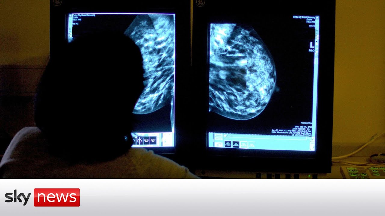 Cancer cases to top half a million per year in the UK by 2040