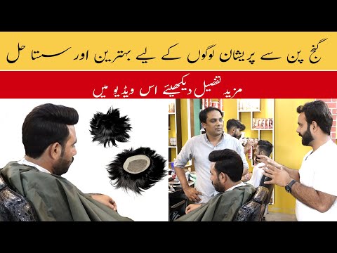 Hair Patches in Pakistan