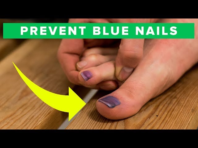 How to Keep Your Baseball Toenails in Top Condition