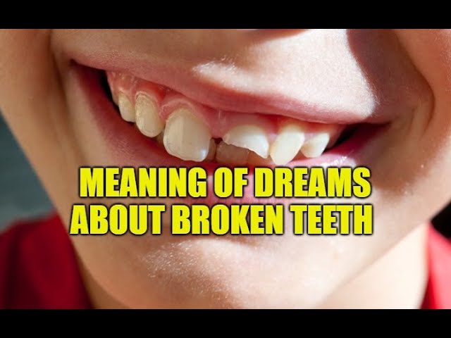 what-does-it-mean-to-dream-about-broken-jaw-stuffsure