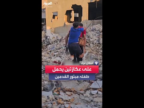 أب في غزة يمشي على عكازتين حاملا طفله الذي بترت قدماه في القصف