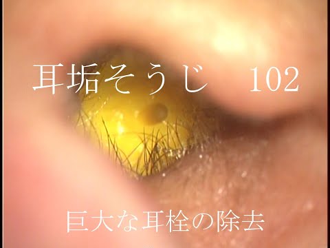 耳垢そうじ Earwaxの最新動画 Youtubeランキング