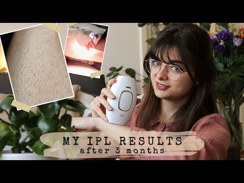 Video: I Used IPL On Only One Side For 3 Months 🦵 Close-Up Results