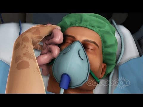 Surgeon Simulator 2013 - Random Encounter - UCbu2SsF-Or3Rsn3NxqODImw