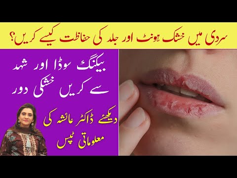 Dry Lips Home Remedy | Khushk Honto Ka Ilaj | Body Itching in Winter | Dr. Ayesha Abbas Tips