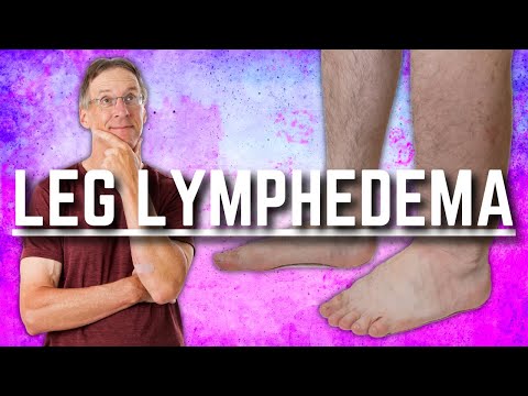 Top 3 Exercises for Leg Lymphedema (Swelling or Edema) - UCmTe0LsfEbpkDpgrxKAWbRA