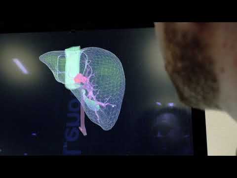 Detect Cancer Faster with AI Demo at Lenovo Transform 2.0 - UCpvg0uZH-oxmCagOWJo9p9g