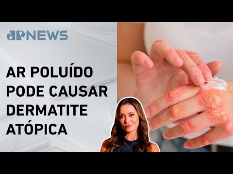 Poluição do ar ajuda a agravar doenças de pele; Patrícia Costa analisa