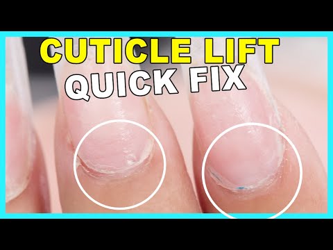 Fix Ugly Cuticles FAST⏱ - No Nail Fill Required