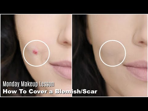 How To Cover Acne & Scars & Blemishes | Monday Makeup Lesson - UC-1-zPmT368J8JRbsK_1keA