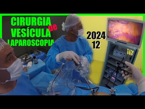 Cirurgia de Vesícula por Videolaparoscopia