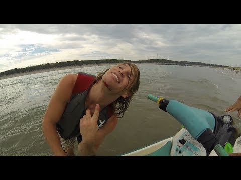 Vlog #3 - Chin Cut from Jetski accident - UCTs-d2DgyuJVRICivxe2Ktg