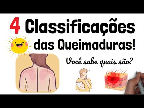 Classificação das Queimaduras Você sabe diferenciar os 4 tipos Aula