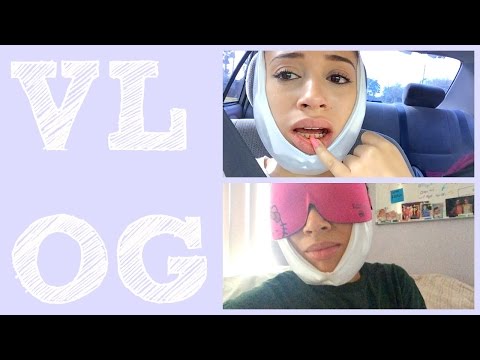 Getting My WISDOM TEETH OUT - UCT5yFEDO-zY1D1vrPyglmsg