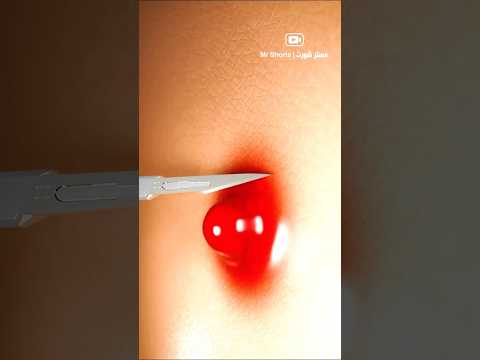 ماذا يوجد داخل الكيس العصعصى؟ 😲😲 #shorts