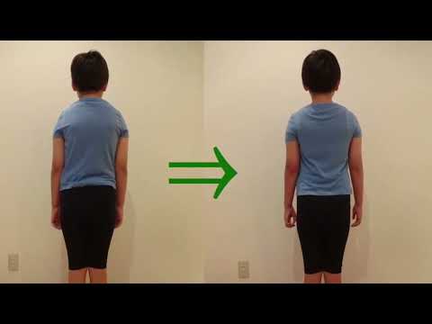 子供姿勢矯正の効果実績39 posture correction for child before and after