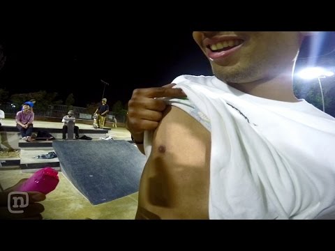 Nipple Taser shots in Game of S.K.A.T.E on NKA - UCsert8exifX1uUnqaoY3dqA