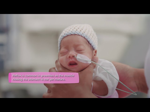 What is Preemie Size? - StuffSure