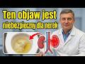 NERKI MILCZ do samego koca  Nie przegap TYCH 7 OBJAWУW![1]