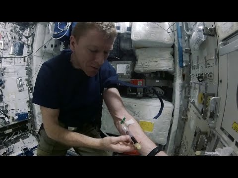 Tim Peake: how to draw blood in space - UCIBaDdAbGlFDeS33shmlD0A