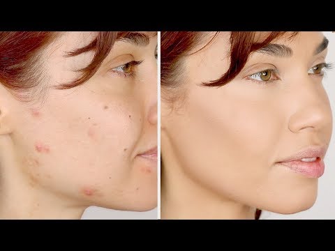 HOW TO COVER ACNE | Flawless Foundation Routine for Acne | Eman - UCaZZh0mI6NoGTlmeI6dbP7Q