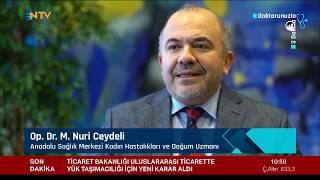 Op. Dr. Nuri Ceydeli - Yumurtalık kisti nedir? Yumurtalık kisti belirtileri nelerdir? - NTV