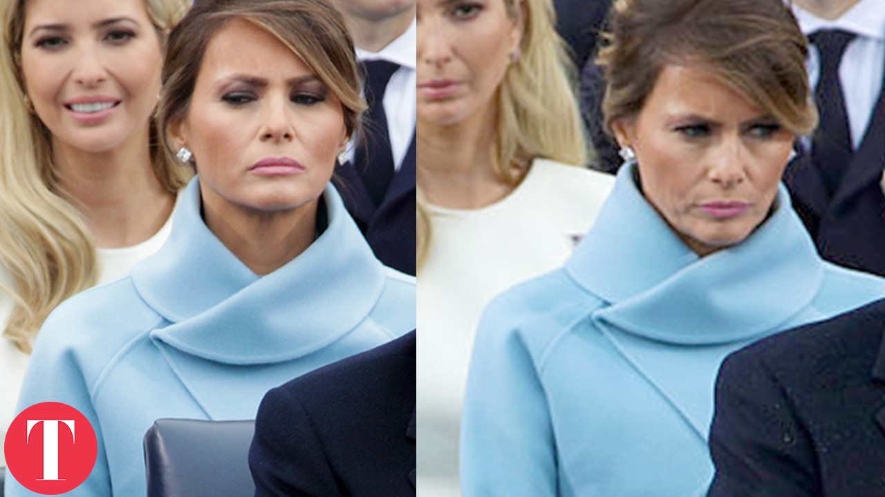 Мелания Трамп До И После Пластики Фото