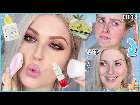 Easy Skincare Routine! ? How To Clear ACNE & Get FLAWLESS Skin!
