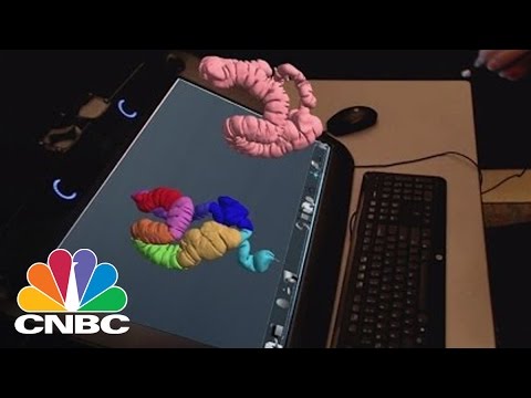 Echopixel's True 3D Gives Doctors A Holographic Look At Your Insides | CNBC - UCvJJ_dzjViJCoLf5uKUTwoA