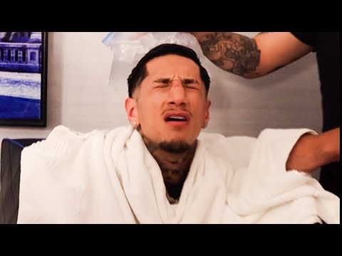 Fernando Vargas Jr WEIGHT CUT Hours Before Weigh-In | “Sh*t Fans Don’t See” Exclusive BTS 🥵