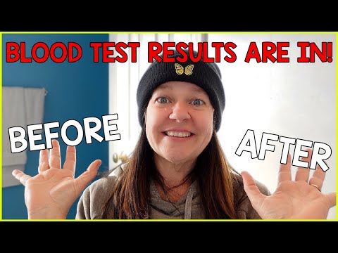WHAT HAPPENS TO YOUR BLOOD 🩸 AFTER LOOSING 125 POUNDS? | MAXIMUM WEIGH LOSS | STARCH SOLUTION