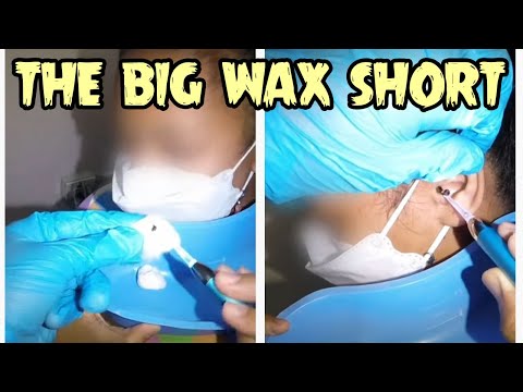 Earwax Short of the Day - Big Wax