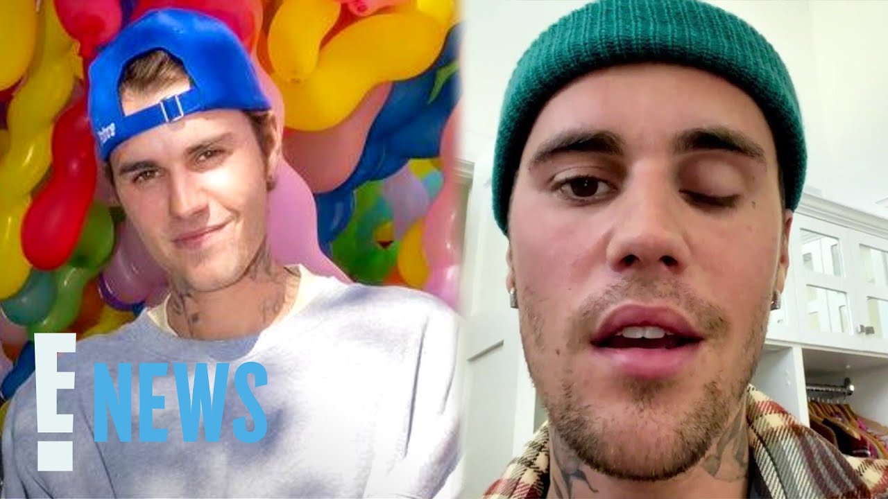 Justin Bieber Shares New Update on His Facial Mobility | E! News