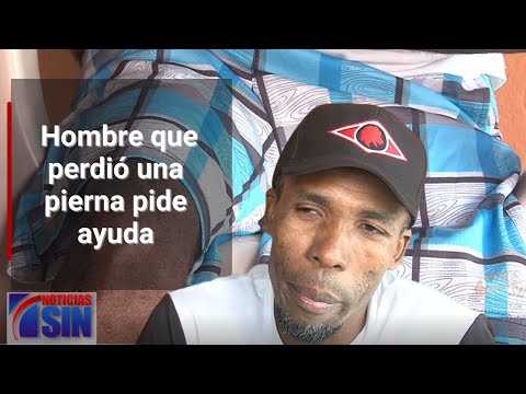 Hombre que perdió una pierna pide ayuda