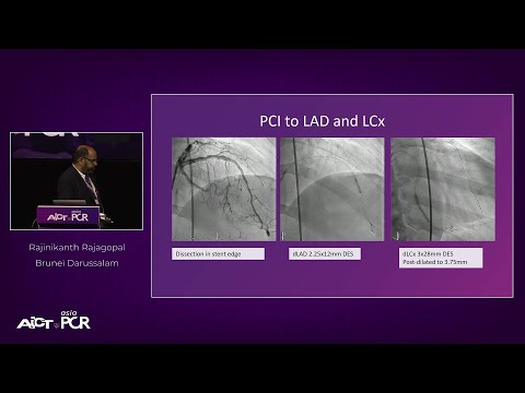 Treatment of small vessel disease – To stent or not to stent? – AICT-AsiaPCR 2022