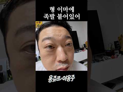 <strong>형</strong> 이마에 족발 붙어있어