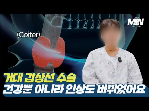 거대 갑상선(Goiter) 수술, 건강뿐 아니라 ..