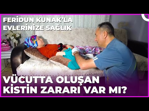 Vücutta Oluşan Kisti Tamamen Yok Etme Yöntemi | Dr. Feridun Kunak’la Evlerinize Sağlık