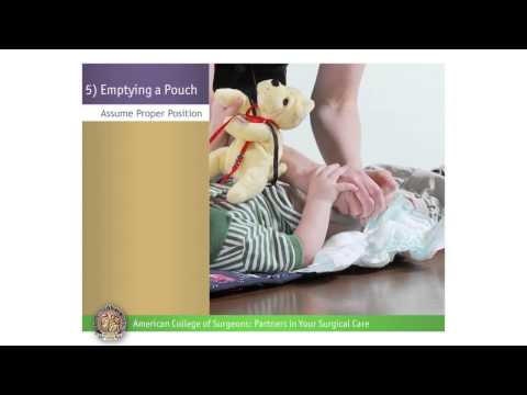 Pediatric Urostomy: Emptying a Pouch